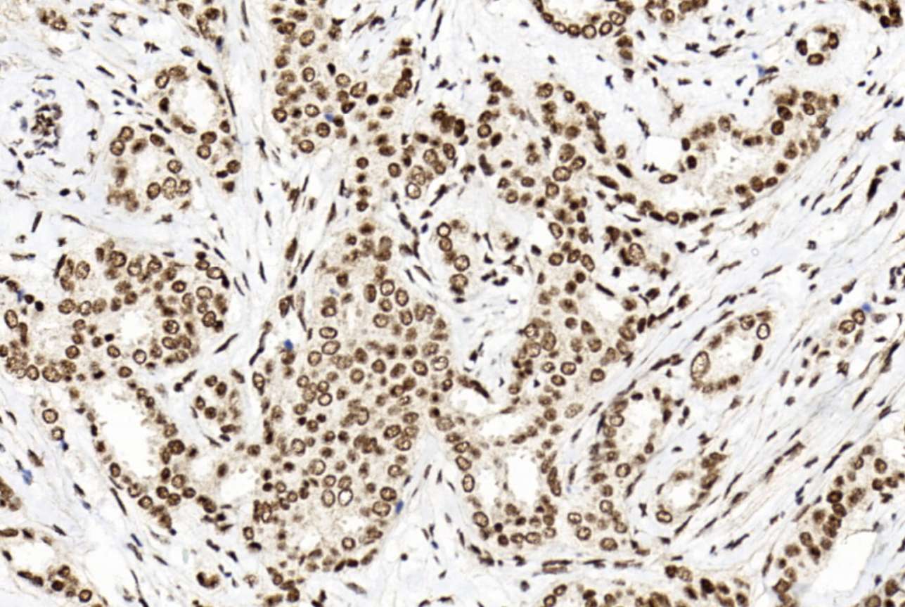 IHC-P - PTBP1 Antibody(N-term) AP19710a